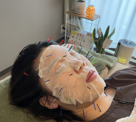 Salus鍼灸サロン 高級パック美容鍼のメニュー画像