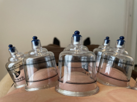 Salus鍼灸サロン 吸い玉(カッピング)のメニュー画像