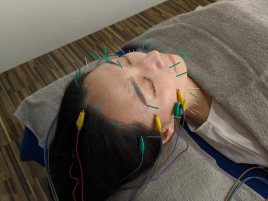 美容鍼灸院 Glanz-グランツ-四条寺町 肌質改善／初回トライアルのメニュー画像