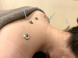 美容鍼灸院 Glanz-グランツ-四条寺町 自律神経改善のメニュー画像