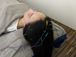 美容鍼灸院 Glanz-グランツ-四条寺町 頭皮鍼のメニュー画像