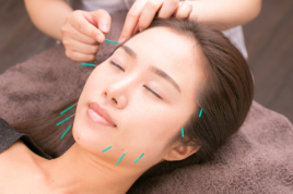 iCure鍼灸接骨院　イオンスタイル品川シーサイド iCure式美容鍼灸のメニュー画像