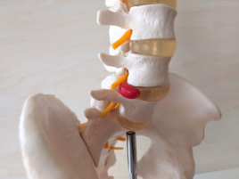 大きな森の鍼灸整骨院　西小倉駅院 ヘルニアのメニュー画像