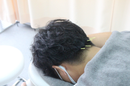 鍼灸院整骨院ティップ春日院 ティップコースのメニュー画像