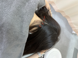 鍼灸院整骨院ティップ春日院 プレミアムティップコースのメニュー画像