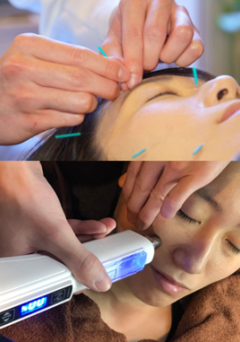 鍼灸整骨院 レメディ 【初回】再生美容鍼コース（幹細胞）のメニュー画像