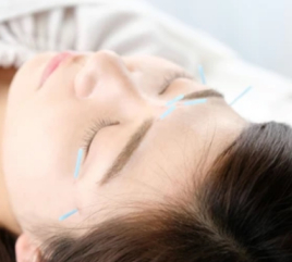 OASE beautysalon（オアゼ） 美容鍼ベーシックのメニュー画像