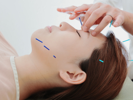 健康美容鍼灸サロンS.P.A桂坂 お顔の美容鍼のメニュー画像