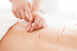 武庫之荘駅前鍼灸接骨院 肩こり・腰痛鍼のメニュー画像