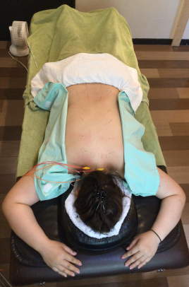 細胞美容サロンCB 体の鍼のメニュー画像