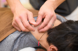 原田治療院 鍼灸施術（痛みやコリ・しびれなど）のメニュー画像