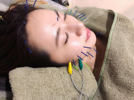 かきざわ鍼灸指圧マッサージ院 美容灸＋美容パルス＋美容耳針のメニュー画像