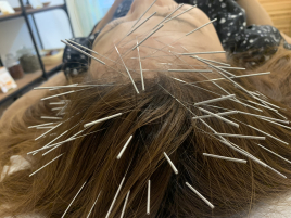 Runa ルート治療90分のメニュー画像