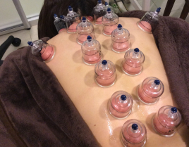 Well-beプラーカ鍼灸室 水素カッピングのメニュー画像