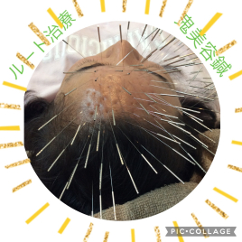 ワイズ宜野湾整骨院はりきゅう 美容鍼のメニュー画像