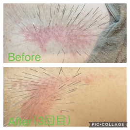 ワイズ宜野湾整骨院はりきゅう ルート治療のメニュー画像