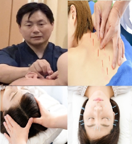 やわらげ鍼灸room 鍼灸治療60分+美容鍼のメニュー画像