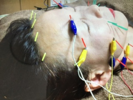 上尾よもぎ鍼灸院 ご顔電流鍼のメニュー画像