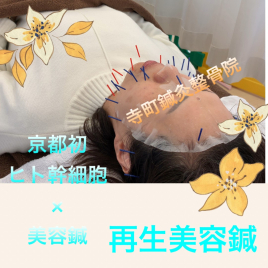 寺町鍼灸整骨院 再生美容コース(ヒト幹細胞再生美容鍼）のメニュー画像
