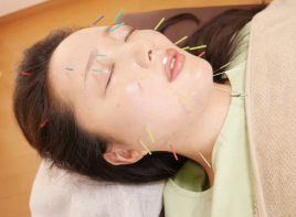 Sprout鍼灸治療院 美容鍼＋総合治療のメニュー画像