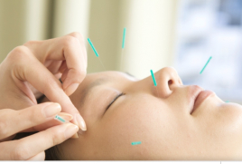 久保鍼灸院 美容ハリのメニュー画像