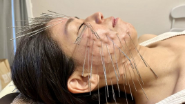 はり・きゅう「和と輪」　ルート治療専門院 ルート治療　鬼美容鍼のメニュー画像