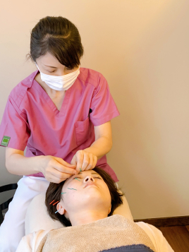 慶kei鍼灸院 たるみ改善◆美容鍼◆のメニュー画像