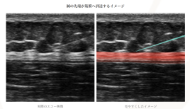 とよた鍼灸サロンHAL 筋膜リリース鍼灸コースのメニュー画像