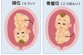 ファミール産院いちかわ 鍼灸治療室 逆子治療のメニュー画像