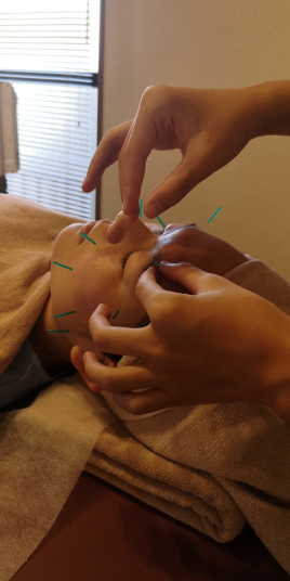 Kirschbaum鍼灸マッサージ治療院 フェイシャルのメニュー画像