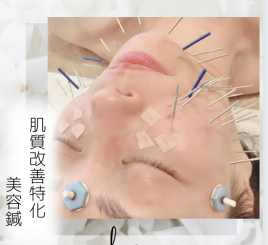 鍼灸サロン　la mer 人気No.2【肌質改善特化★美容鍼】】のメニュー画像
