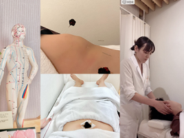 南麻布鍼灸治療室　美巡究 ②全身の経絡鍼灸：Plusのメニュー画像