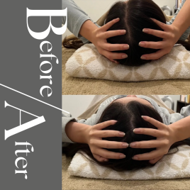 美容鍼灸サロンAimer 頭鍼ヘッドスパ　60分コースのメニュー画像