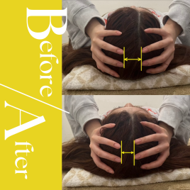 美容鍼灸サロンAimer 頭鍼ヘッドスパ　40分コースのメニュー画像
