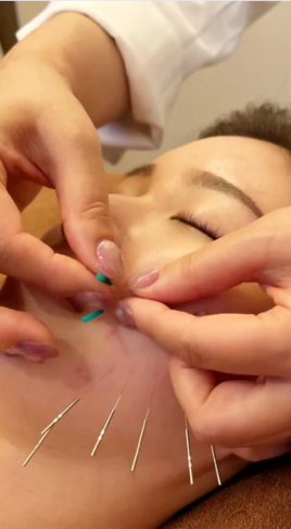 鍼灸サロン Hari-Cure キュッキュッと小顔美容鍼のメニュー画像