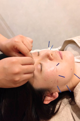 女性のための鍼灸サロンtete 美容鍼のメニュー画像