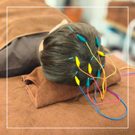 はりCure 【育毛鍼灸】フサフサしんきゅうのメニュー画像