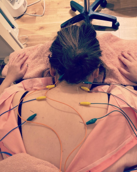 HARIKYULAB 鍼灸　お灸のメニュー画像