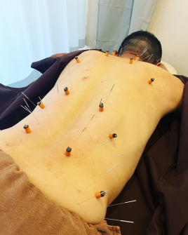 鍼灸＆ボディケアサロン大濠ベッラ 鍼灸施術（腰痛）のメニュー画像