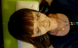 はり灸アロマ心音 【初回限定】顔コース+➇プラス灸のメニュー画像