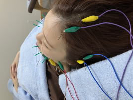 Nagi鍼灸治療院 立体造顔美容鍼のメニュー画像
