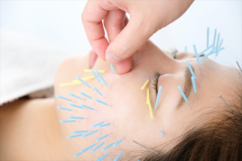 Mitsuba-therapy （みつば治療・整骨院内） 美容鍼・美顔鍼のメニュー画像