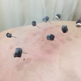 鍼灸整骨カラダステーション 自律神経調整のメニュー画像