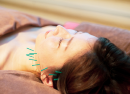 鍼灸整体　LightHouse 美容鍼（ベースライン）（JMCAA認定）のメニュー画像