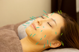 永井鍼灸接骨院 美容鍼のメニュー画像