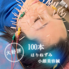 はりねずみ鍼灸接骨院 100本はりねずみ小顔美容鍼のメニュー画像
