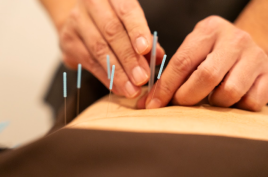 茂市堂 鍼灸治療　のメニュー画像