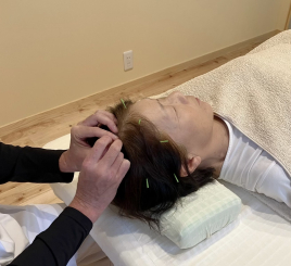 ゆい治療院 頭快鍼(とうかいしん)＋ヘッドスパコースのメニュー画像