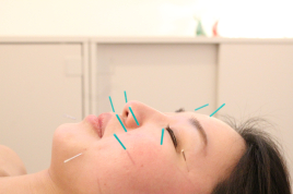 鍼灸 玉兎治療院 電気を流すベーシック美容鍼のメニュー画像
