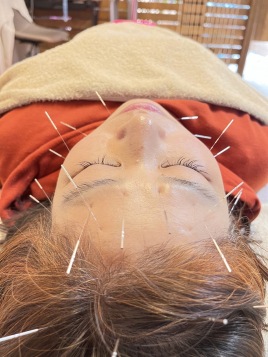 CLOVERはり整体治療院 整体＋美容鍼　ロングのメニュー画像